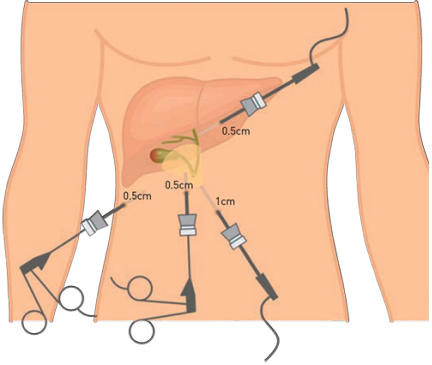 Instrument placement